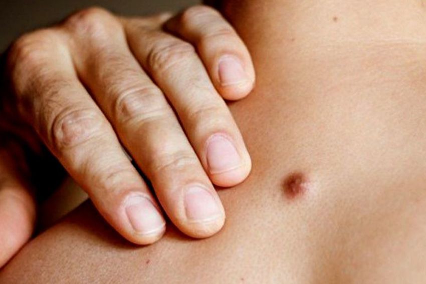 Khasiat Surat Al-Munafiqun, Bisa Menyembuhkan Bisul