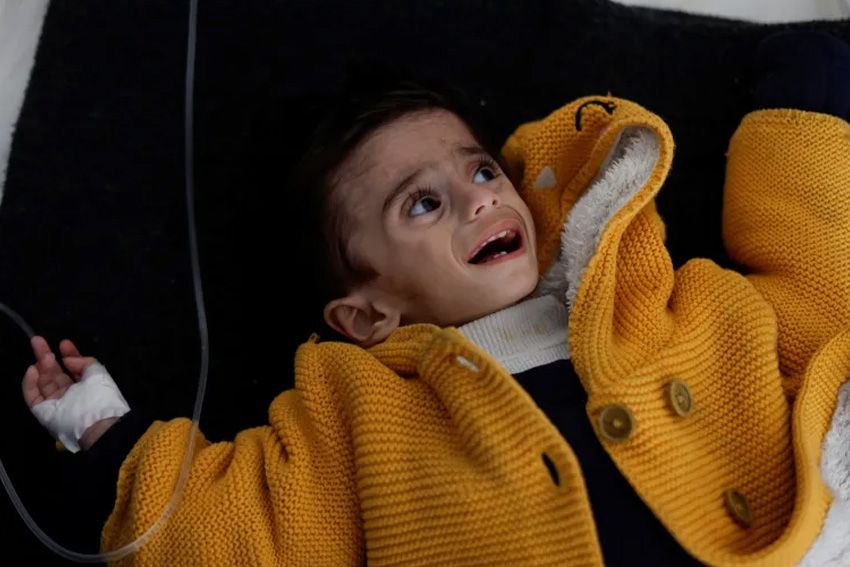 3.500 Anak Palestina Berisiko Meninggal karena Kelaparan