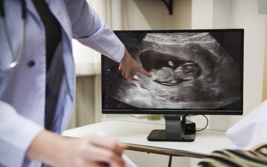 Agar Tak Jadi Korban Asusila, Ini SOP Pemeriksaan ke Dokter Kandungan  – Portal Berita Islam